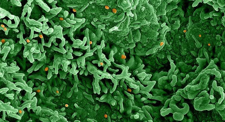 MPOX La decisión se produce después de las noticias sobre la continua propagación de la enfermedad, conocida anteriormente como la viruela del mono, con un aumento de los casos a niveles sin precedentes en África.